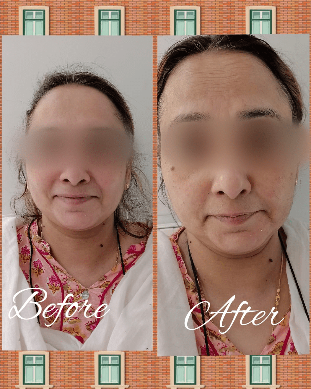 Anti-Ageing Facial