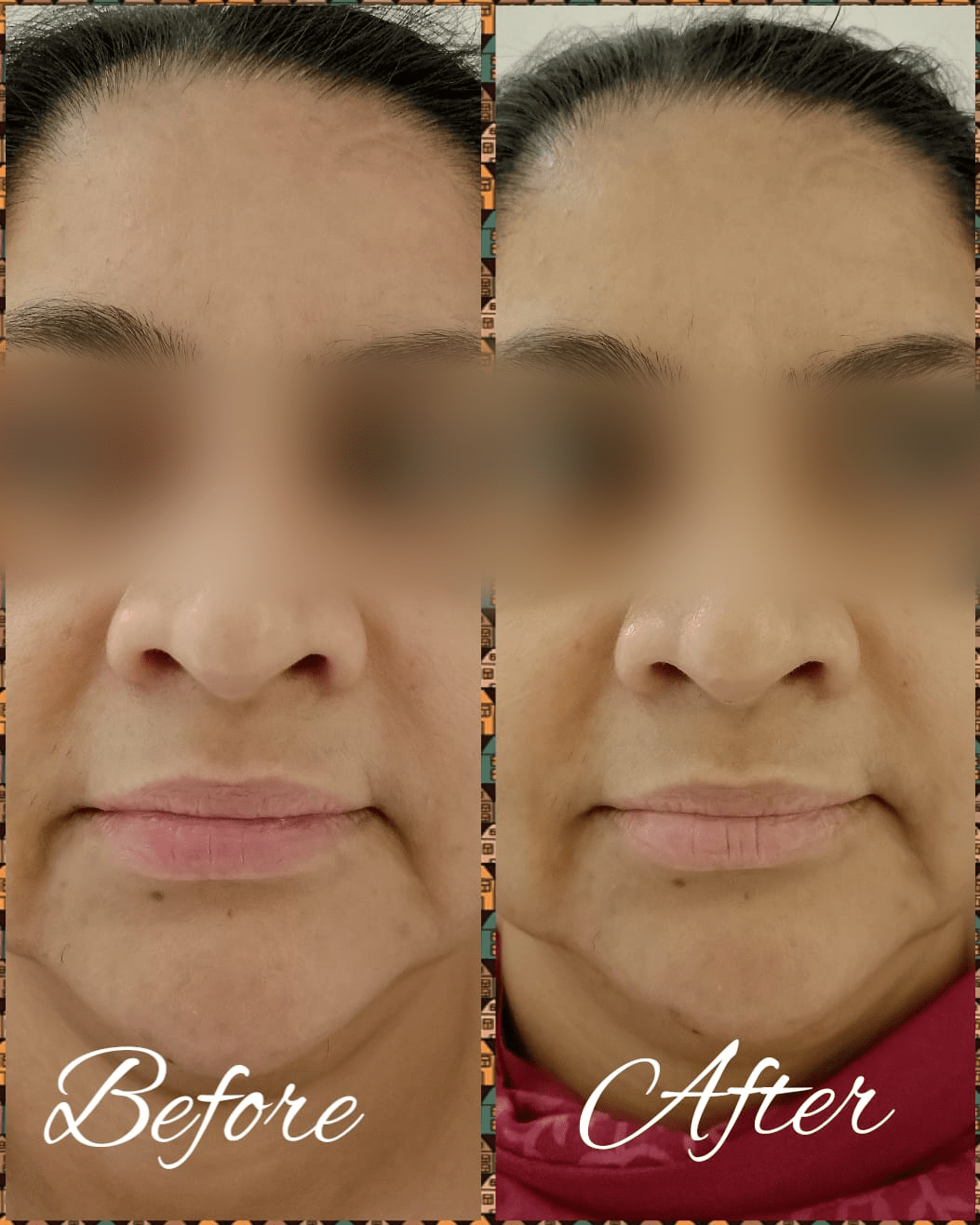 Anti-Ageing O3 Facial